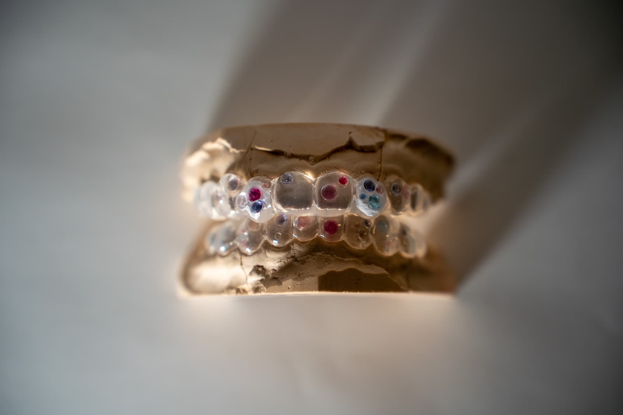 Custom Paranoia gem-set grillz